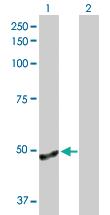 Anti-ANGPTL4 Rabbit Polyclonal Antibody