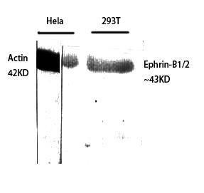 Anti-EFNB1 and EFNB2 antibody