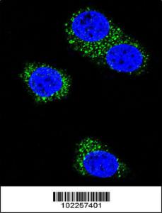 Anti-PSEN1 Rabbit Polyclonal Antibody (HRP (Horseradish Peroxidase))