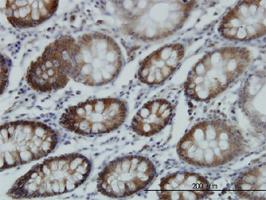 Anti-RTKN Mouse Monoclonal Antibody [clone: 2E5]