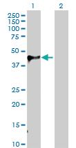 Anti-WIF1 Rabbit Polyclonal Antibody