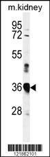 Anti-MARCH5 Rabbit Polyclonal Antibody (APC (Allophycocyanin))