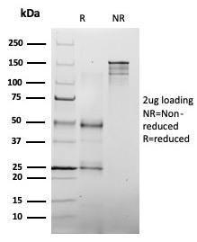 SDS-PAGE analysis of Anti-MLH1 Antibody [MLH1/6467] under non-reduced and reduced conditions; showing intact IgG and intact heavy and light chains, respectively. SDS-PAGE analysis confirms the integrity and purity of the antibody.