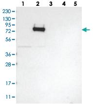 Anti-COLGALT2 Rabbit Polyclonal Antibody