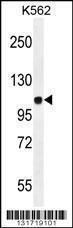 Anti-JAG1 Rabbit Polyclonal Antibody (Biotin)