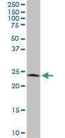 Anti-PGRMC2 Mouse Monoclonal Antibody [clone: 3C11]