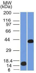 Western blot analysis of (Lane 1) recombinant AMACR protein and (Lane 2) human kidney lysate using Anti-AMACR Antibody [AMACR/1864]