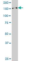 Anti-SUPT16H Mouse Monoclonal Antibody [clone: 1D12]