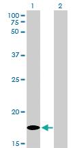 Anti-MCFD2 Mouse Monoclonal Antibody [clone: 3A5-G4]