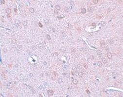 Anti-DCLK1 Rabbit Polyclonal Antibody