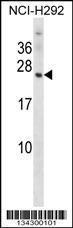 Anti-OMP Rabbit Polyclonal Antibody (Biotin)