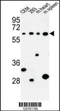 Anti-PLCZ1 Rabbit Polyclonal Antibody