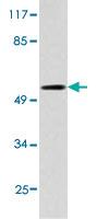 Anti-CHEK1 Rabbit Polyclonal Antibody