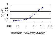 Anti-PGRMC2 Mouse Monoclonal Antibody [clone: 3C11]