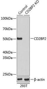 Western blot analysis of extracts from normal (control) and CD2BP2 knockout (KO) 293T cells, using Anti-CD2BP2 Antibody (A307616) at 1:1,000 dilution. The secondary antibody was Goat Anti-Rabbit IgG H&L Antibody (HRP) at 1:10,000 dilution.