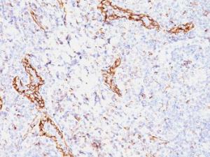 Immunohistochemical analysis of formalin-fixed, paraffin-embedded human tonsil using Anti-VEGF Antibody [VEGF/1063]