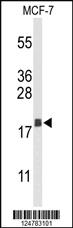 Anti-PRKCG Rabbit Polyclonal Antibody