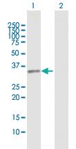 Anti-PROCR Rabbit Polyclonal Antibody