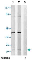 Anti-DNPH1 Rabbit Polyclonal Antibody