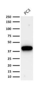 Western blot analysis of human prostate cancer PC-3 cell lysate using Anti-AMACR Antibody [AMACR/1864]