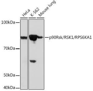 Western blot analysis of extracts of various cell lines, using Anti-RSK1 p90 Antibody [ARC1096] (A307617) at 1:1000 dilution. The secondary Antibody was Goat Anti-Rabbit IgG H&L Antibody (HRP) at 1:10000 dilution. Lysates/proteins were present at 25 µg per lane