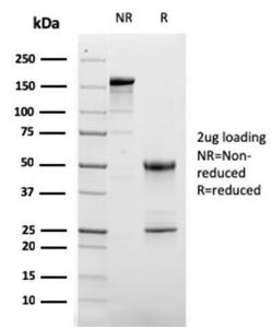 SDS-PAGE analysis of Anti-CD63 Antibody [LAMP3/2881] under non-reduced and reduced conditions; showing intact IgG and intact heavy and light chains, respectively. SDS-PAGE analysis confirms the integrity and purity of the antibody