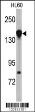 Anti-TRIM62 Rabbit Polyclonal Antibody