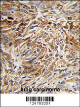 Anti-AGR3 Rabbit Polyclonal Antibody