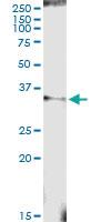 Anti-PROCR Rabbit Polyclonal Antibody