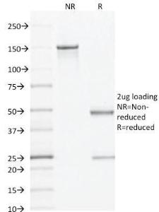 SDS-PAGE analysis of Anti-AMACR Antibody [AMACR/1864] under non-reduced and reduced conditions; showing intact IgG and intact heavy and light chains, respectively. SDS-PAGE analysis confirms the integrity and purity of the antibody