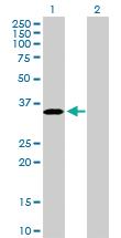 Anti-PROCR Rabbit Polyclonal Antibody