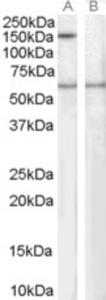 EB06260 staining (1µg/ml) of Human EBV-immortilized lymphoblastoid lysate (RIPA buffer, 35µg total protein per lane). Primary incubated for 1 hour.  Detected by western blot using chemiluminescence.