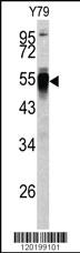 Anti-PDIA6 Rabbit Polyclonal Antibody