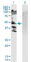 Anti-RSC1A1 Mouse Polyclonal Antibody