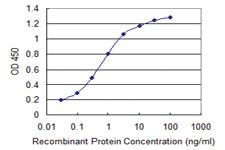 Anti-SUPT16H Mouse Monoclonal Antibody [clone: 2D1]