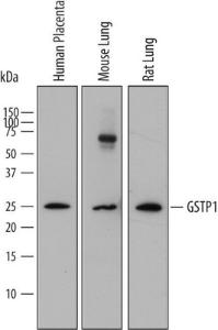 Anti-Glutathione S Transferase, pi 1 Mouse Monoclonal Antibody [clone: 800027]