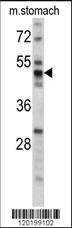 Anti-PDIA6 Rabbit Polyclonal Antibody