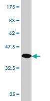 Anti-ITM2B Mouse Monoclonal Antibody [clone: 1A10]