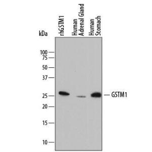 Anti-Glutathione S-Transferase mu 1 Mouse Monoclonal Antibody [clone: 842516]