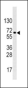 Anti-BMPR1A Rabbit Polyclonal Antibody (AP (Alkaline Phosphatase))