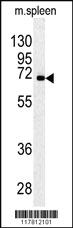 Anti-ESR2 Rabbit Polyclonal Antibody