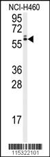 Anti-RUNX2 Rabbit Polyclonal Antibody