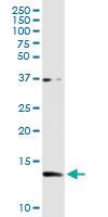 Anti-CSTB Rabbit Polyclonal Antibody