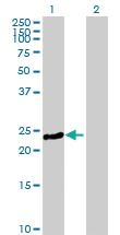 Anti-MYL3 Mouse Polyclonal Antibody