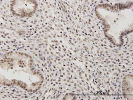 Anti-RSC1A1 Mouse Polyclonal Antibody