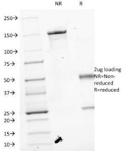 SDS-PAGE analysis of Anti-VEGF Antibody [VEGF/1063] under non-reduced and reduced conditions; showing intact IgG and intact heavy and light chains, respectively. SDS-PAGE analysis confirms the integrity and purity of the Antibody