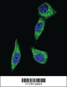 Anti-ESR2 Rabbit Polyclonal Antibody