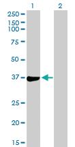 Anti-PHF11 Mouse Polyclonal Antibody