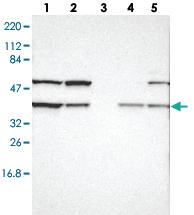 Anti-CECR5 Rabbit Polyclonal Antibody