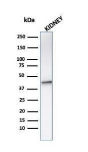 Western blot analysis of kidney tissue lysate using Anti-AMACR Antibody [AMACR/1864]